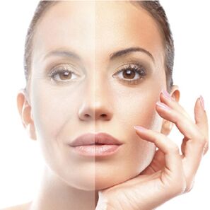 Rejuvenation of the skin of the face