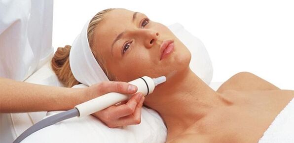 Facial peel